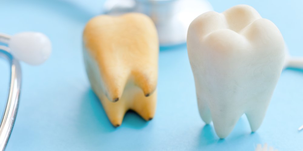 Can Yellow Teeth Become White Again?